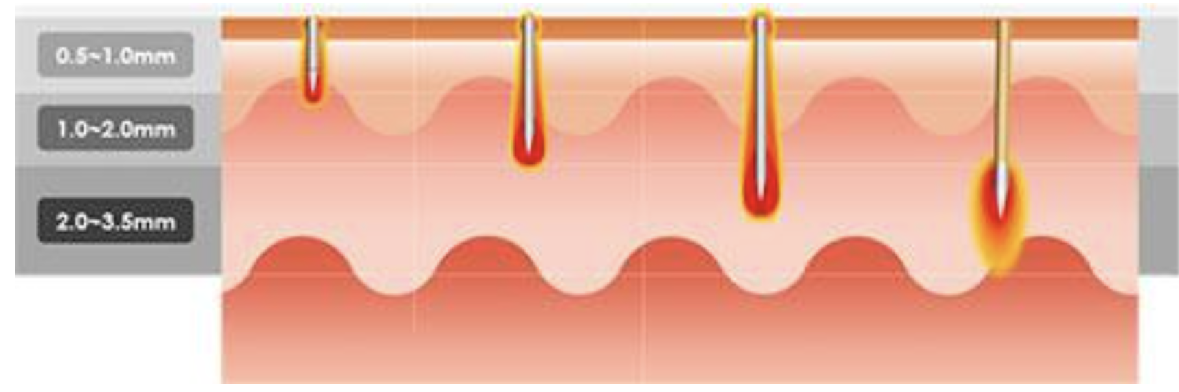 Secret RF Diagram