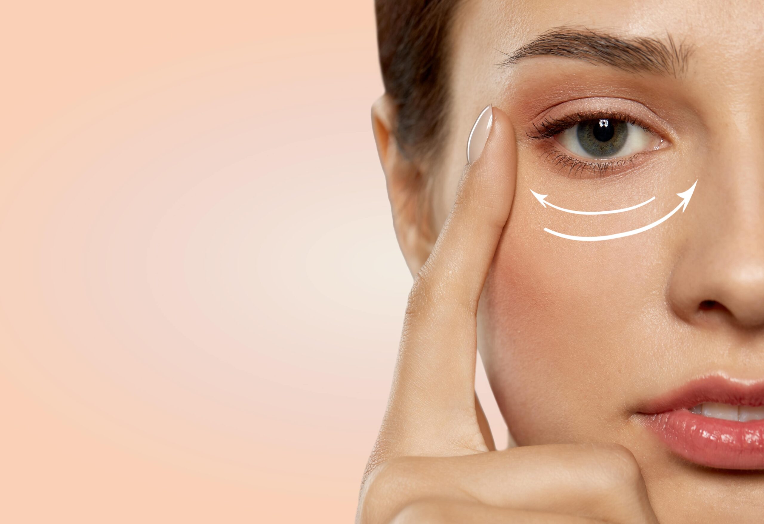 Close-up of a woman's eye with arrows indicating under-eye skin treatment